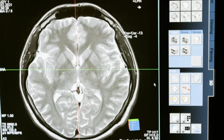 Charles Lieber preia conducerea institutului i-BRAIN din Shenzhen, aducând expertiză americană cercetării neurotehnologice din China